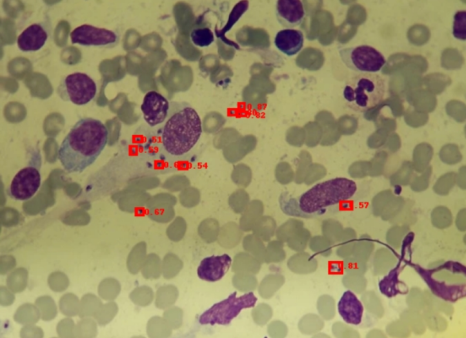 Leishmania Parasite Detection project image